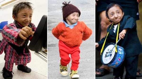 Dünyanın en kısa adamı  öldü 