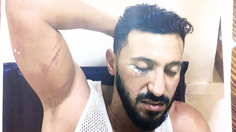 Daria ve Baran adliyeye geldi, ifade verdi: Yumrukla bayıldım